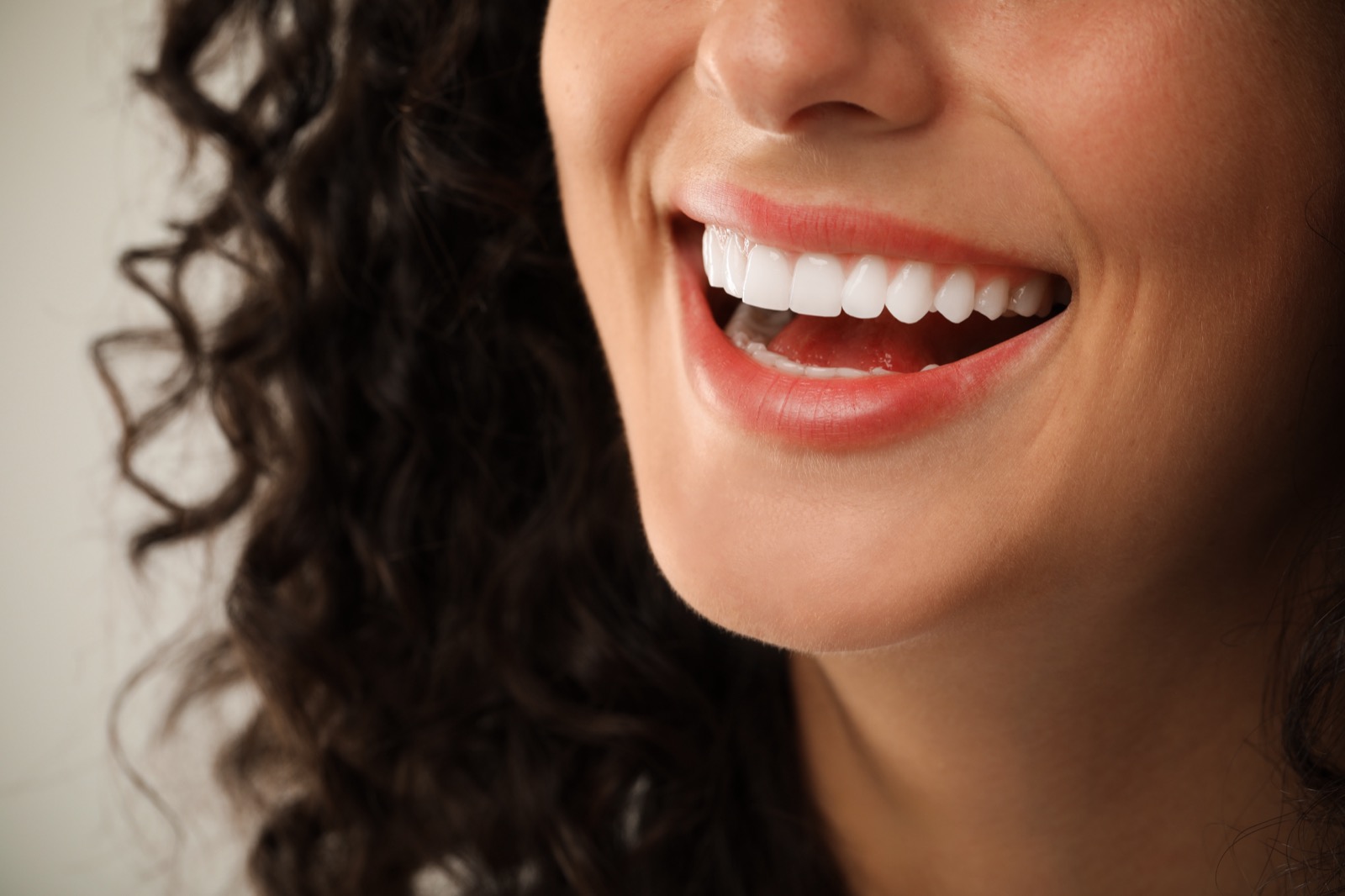 Porcelain veneers example